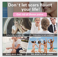 Load image into Gallery viewer, Lancs Acne Scar Removal Serum Skin Repair Essence for Reduces the Appearance of Old &amp; New Scars, Wrinkles, Burns and Recovery Scar Treatment (5ml7 bottles)
