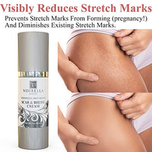 Load image into Gallery viewer, Scar &amp; Bruise Removal Cream - Best Treatment Remedy for Healing, Skin Repair, Fading &amp; Prevention of Old or New Acne &amp; Stretch Mark, Surgical, Keloid, C Section, Pregnancy or Bug Bite Scars &amp; Bruises
