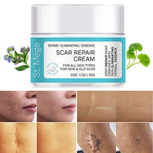 Load image into Gallery viewer, Scar Removal Cream, Scar Cream For Old Scars - Stretch Mark Removal Cream for Men &amp; Women - Stretch Marks Relief and Burns Repair, Face Skin Repair Cream
