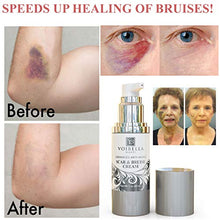 Load image into Gallery viewer, Scar &amp; Bruise Removal Cream - Best Treatment Remedy for Healing, Skin Repair, Fading &amp; Prevention of Old or New Acne &amp; Stretch Mark, Surgical, Keloid, C Section, Pregnancy or Bug Bite Scars &amp; Bruises
