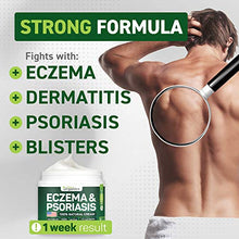 Load image into Gallery viewer, Psoriasis &amp; Eczema Cream - Natural Eczema Treatment with Tea Tree Oil, MSM, Honey &amp; Arnica - Made in USA - Powerful Dermatitis, Irritation &amp; Psoriasis Treatment - Steroid-Free Psoriasis Cream - 4OZ
