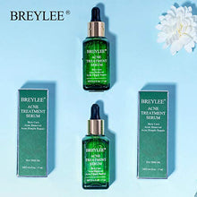 Load image into Gallery viewer, Acne Treatment Serum, BREYLEE Tea Tree Clear Skin Serum for Clearing Severe Acne, Breakout, Remover Pimple and Repair Skin (17ml,0.6oz)
