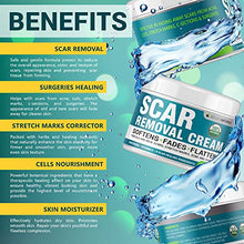 Load image into Gallery viewer, Scar Removal Cream - Effective Stretch Mark Removal - Natural Skin Repair - Acne Scar Remover Cream - Made in USA - Advanced Treatment for Old Scars &amp; Acne Scars - Clinically Proven Formula - 2 OZ
