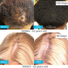 Load image into Gallery viewer, Theradome PRO LH80 - Medical Grade Laser Hair Growth Helmet - FDA Cleared for Men &amp; Women. Promotes Hair Regrowth and Prevents Further Hair Loss with Premium Red Light Lasers
