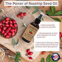 Load image into Gallery viewer, PURA D'OR Organic Rosehip Seed Oil (4oz / 118mL) 100% Pure Cold Pressed USDA Certified Organic, All Natural Anti-Aging Moisturizer Treatment for Face, Hair, Skin, Nails, Men-Women (Packaging may vary)
